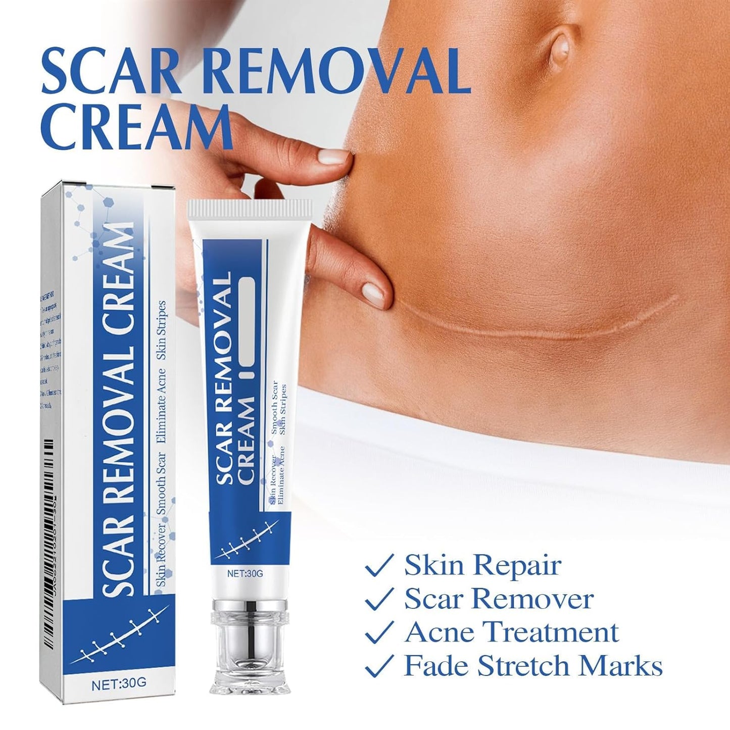 Professional Scar Removal Gel